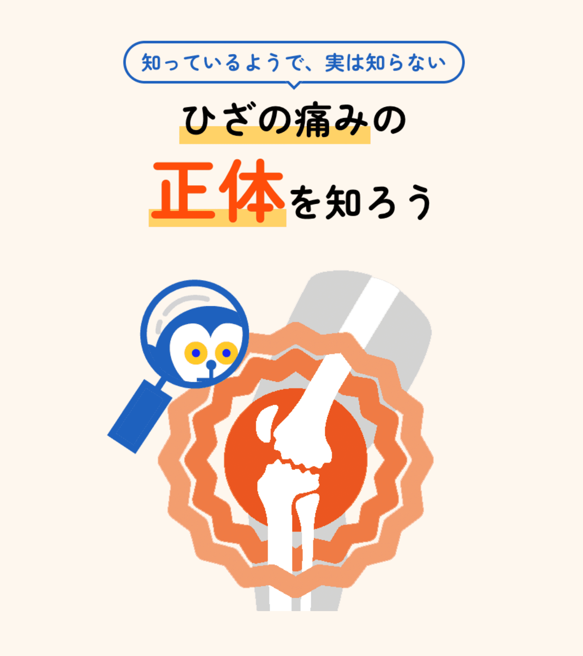 知っているようで、実は知らない ひざの痛みの正体を知ろう